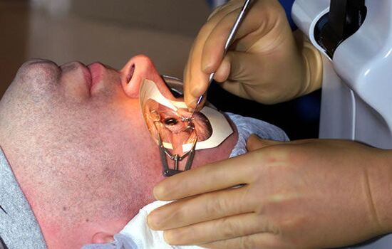 Miyopide görüşü stabilize etmek için skleroplasti